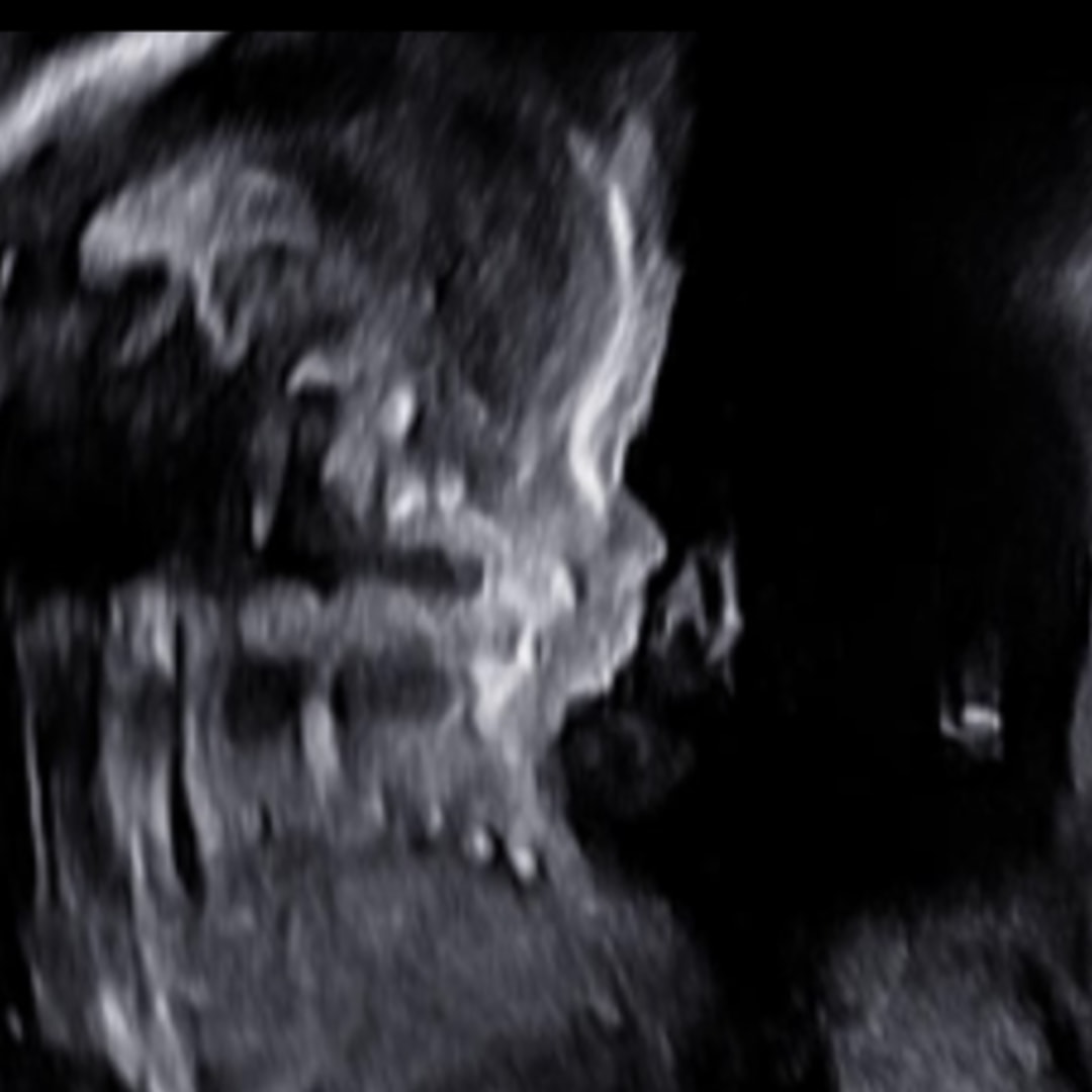 Photo shared by Carly for their Babylist baby registry.