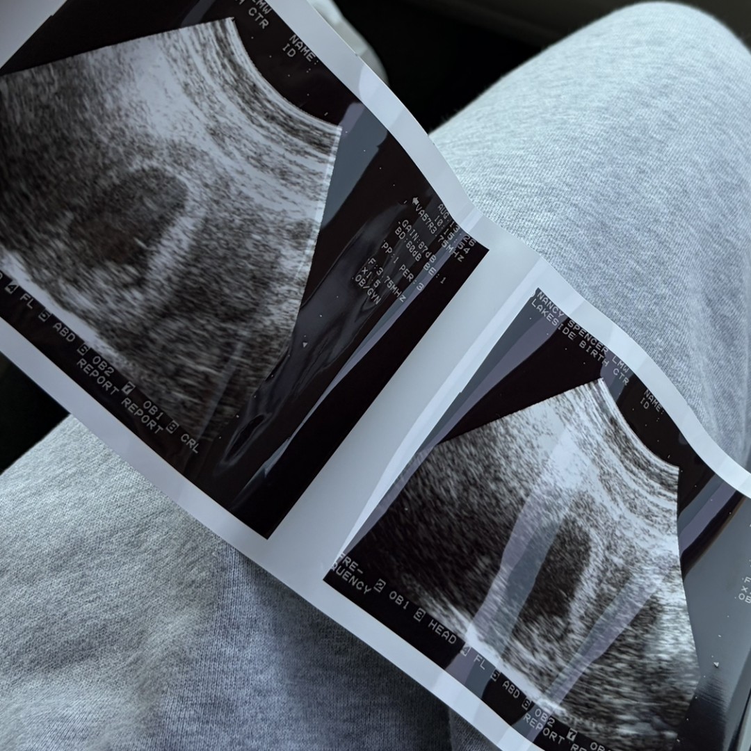 Photo shared by Alexandra for their Babylist baby registry.