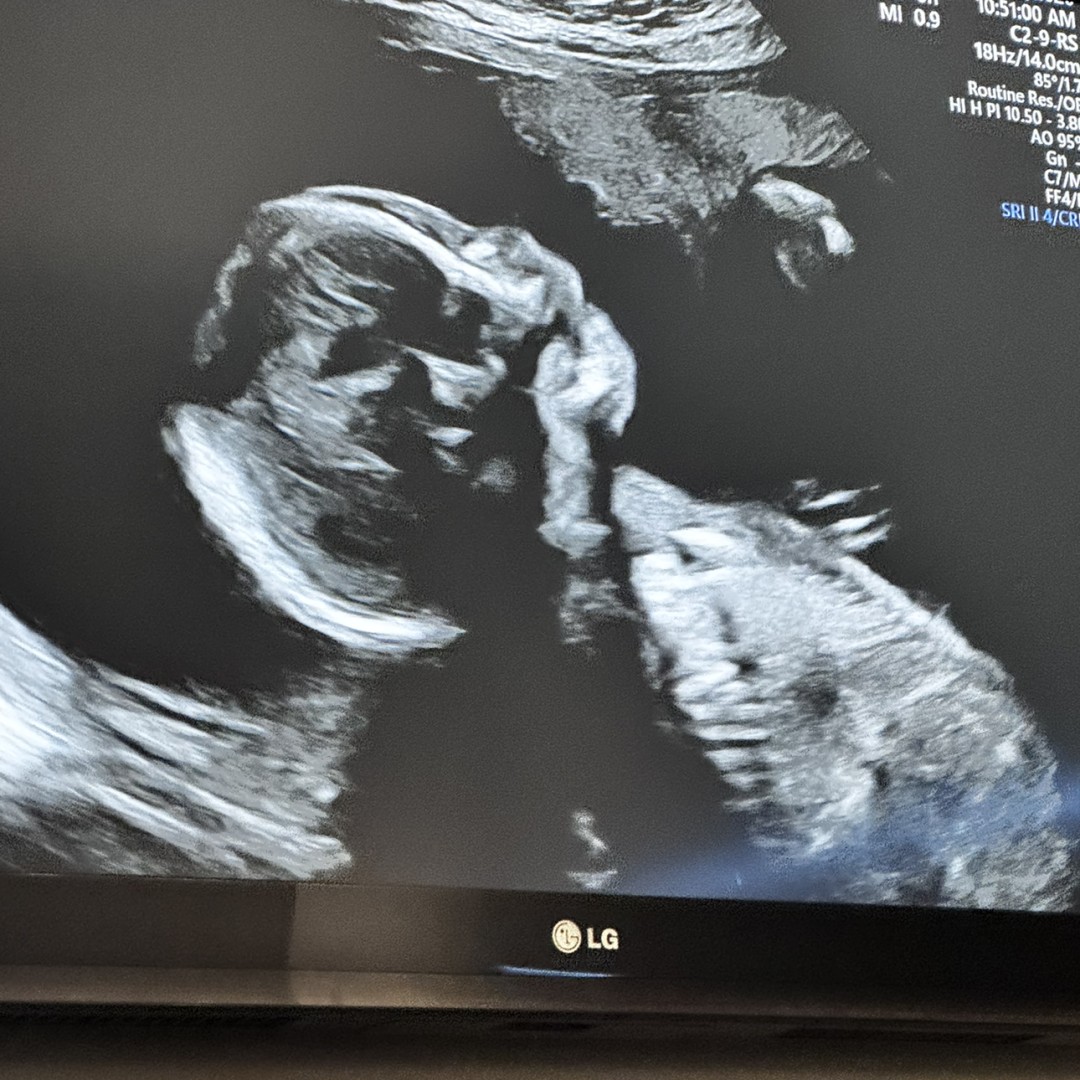 Photo shared by Julia for their Babylist baby registry.