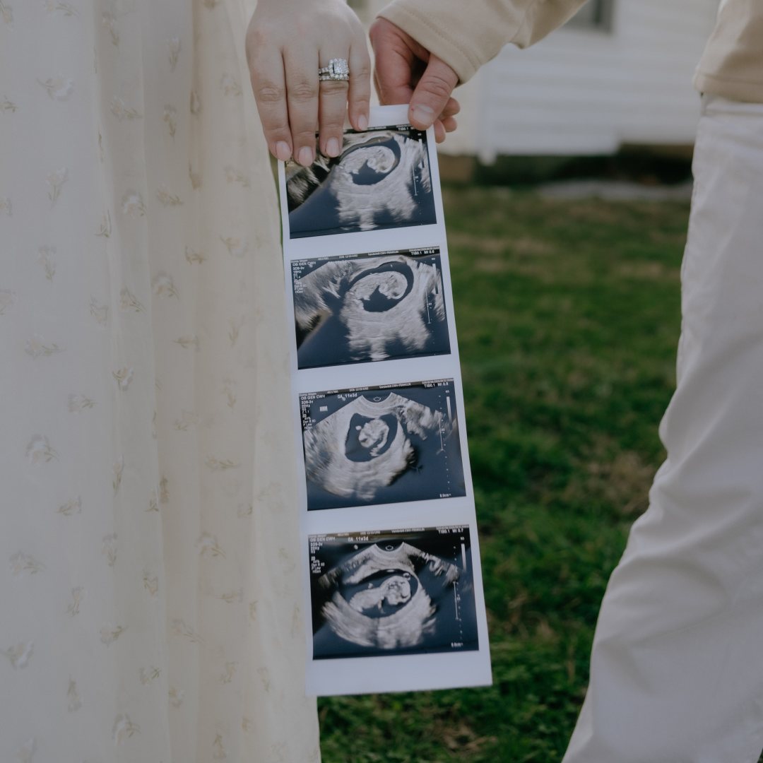 Photo shared by Megan for their Babylist baby registry.