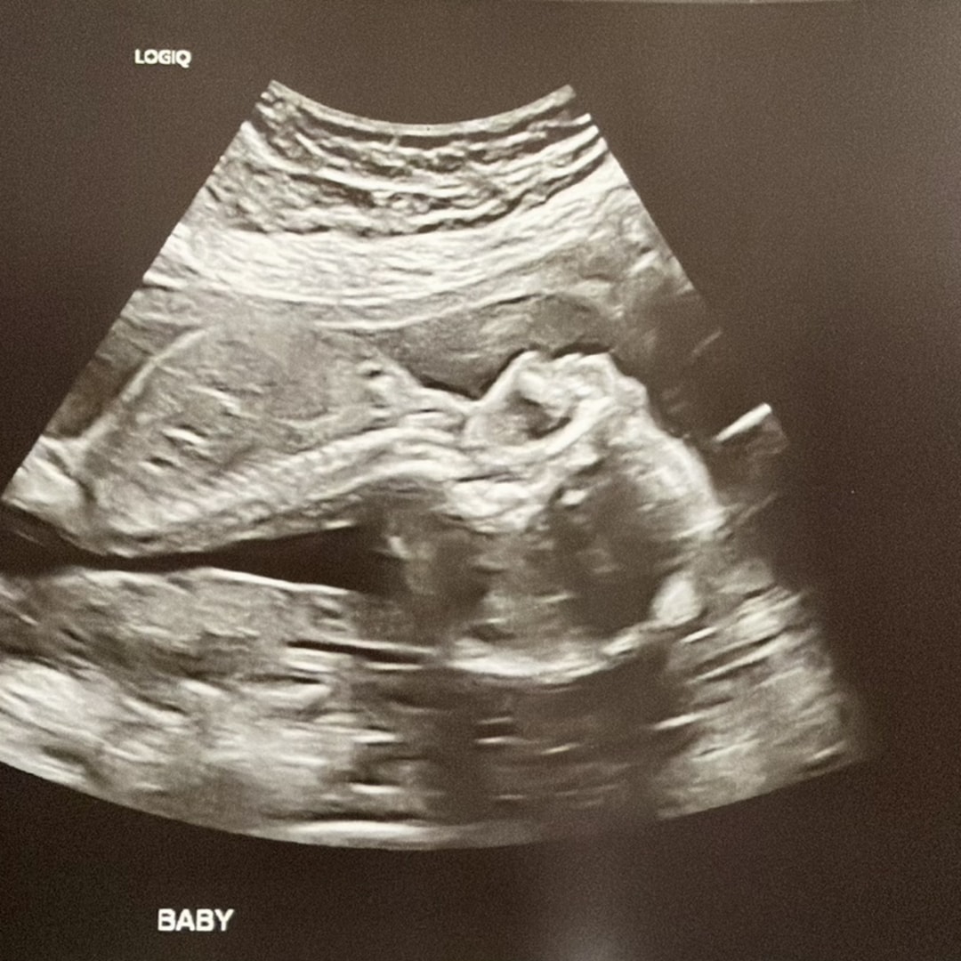 Photo shared by Malina for their Babylist baby registry.