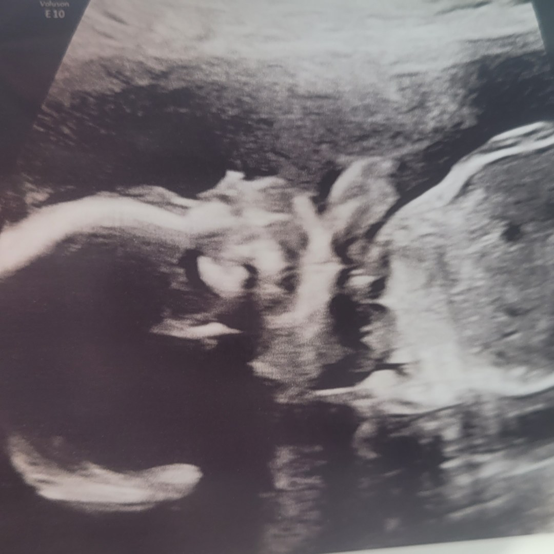 Photo shared by Anna for their Babylist baby registry.