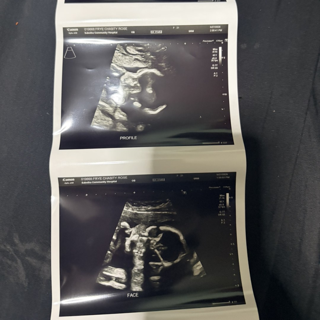 Photo shared by Chasity for their Babylist baby registry.