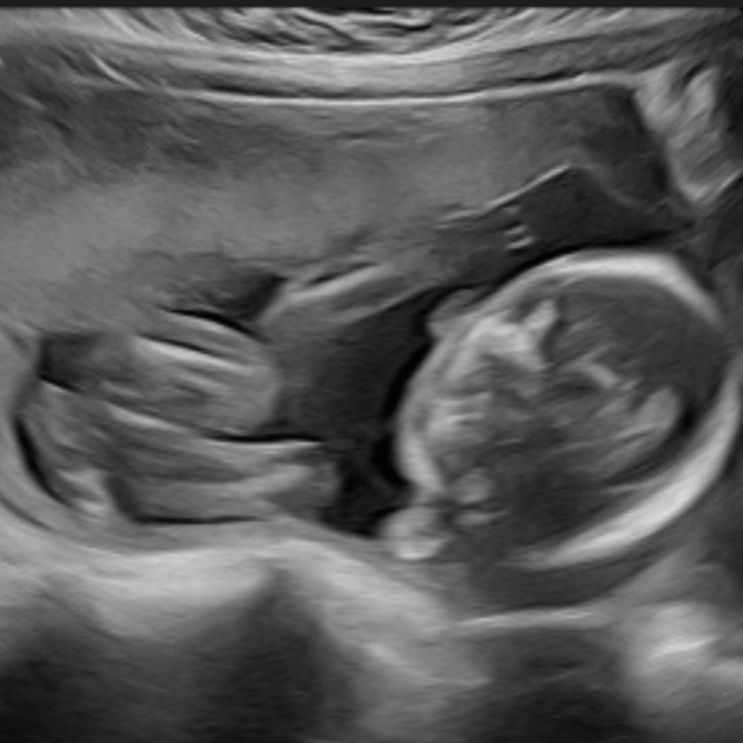 Photo shared by Zoe for their Babylist baby registry.