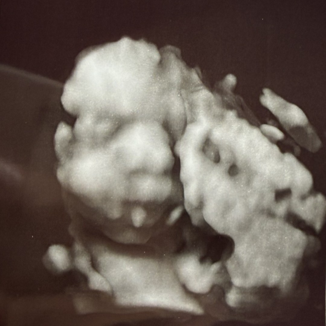Photo shared by Amarilis for their Babylist baby registry.