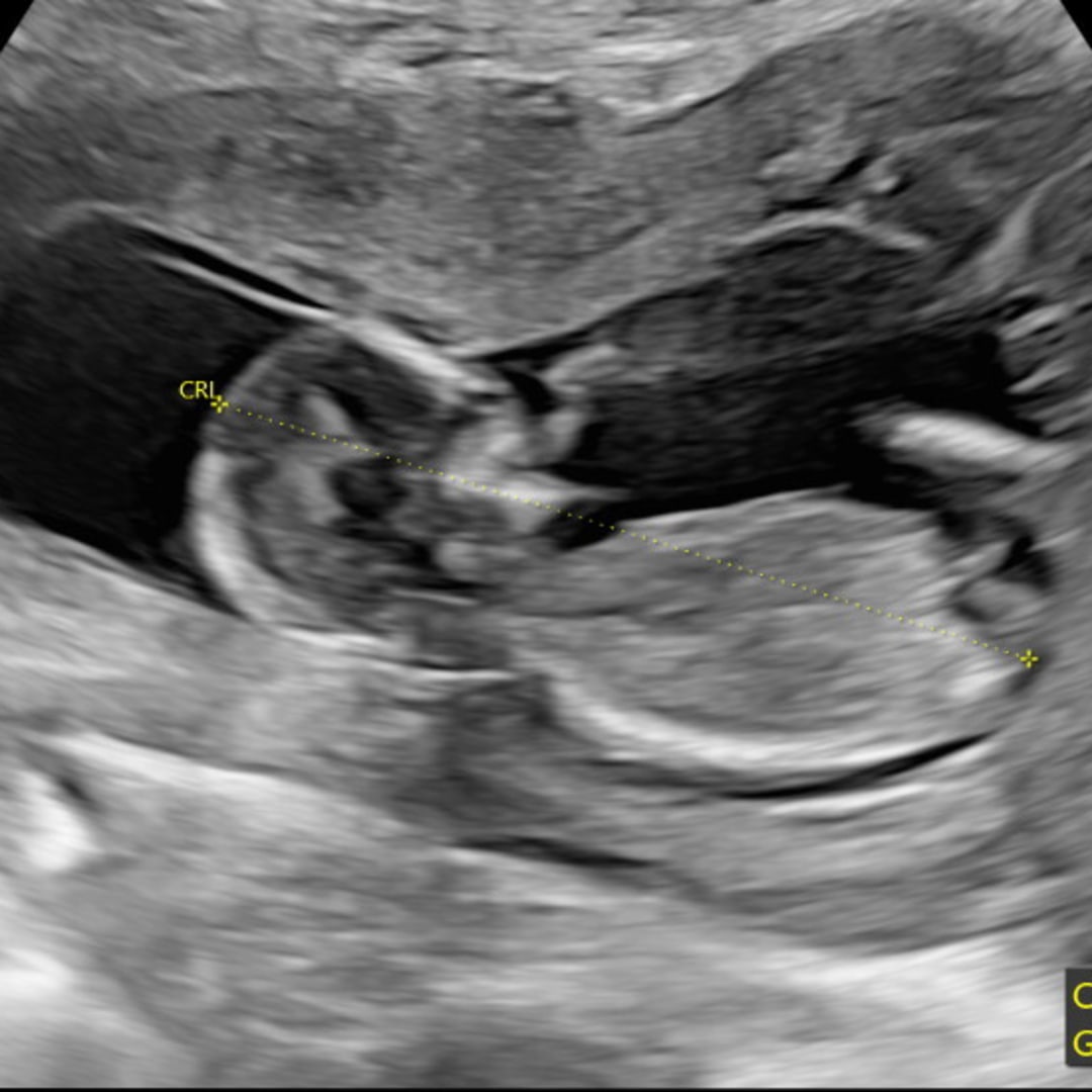 Photo shared by Lizbeidy for their Babylist baby registry.