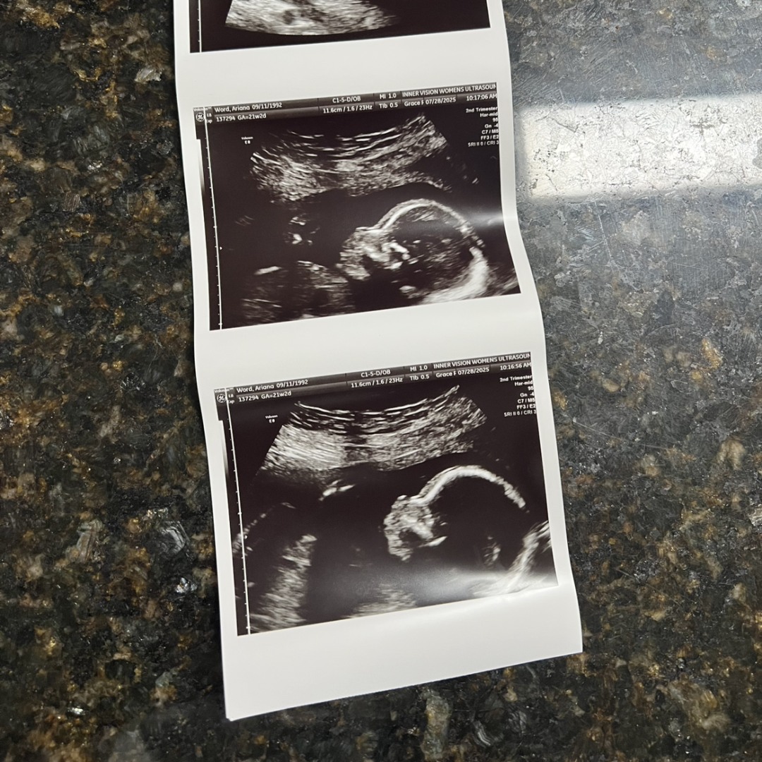 Photo shared by Ariana for their Babylist baby registry.