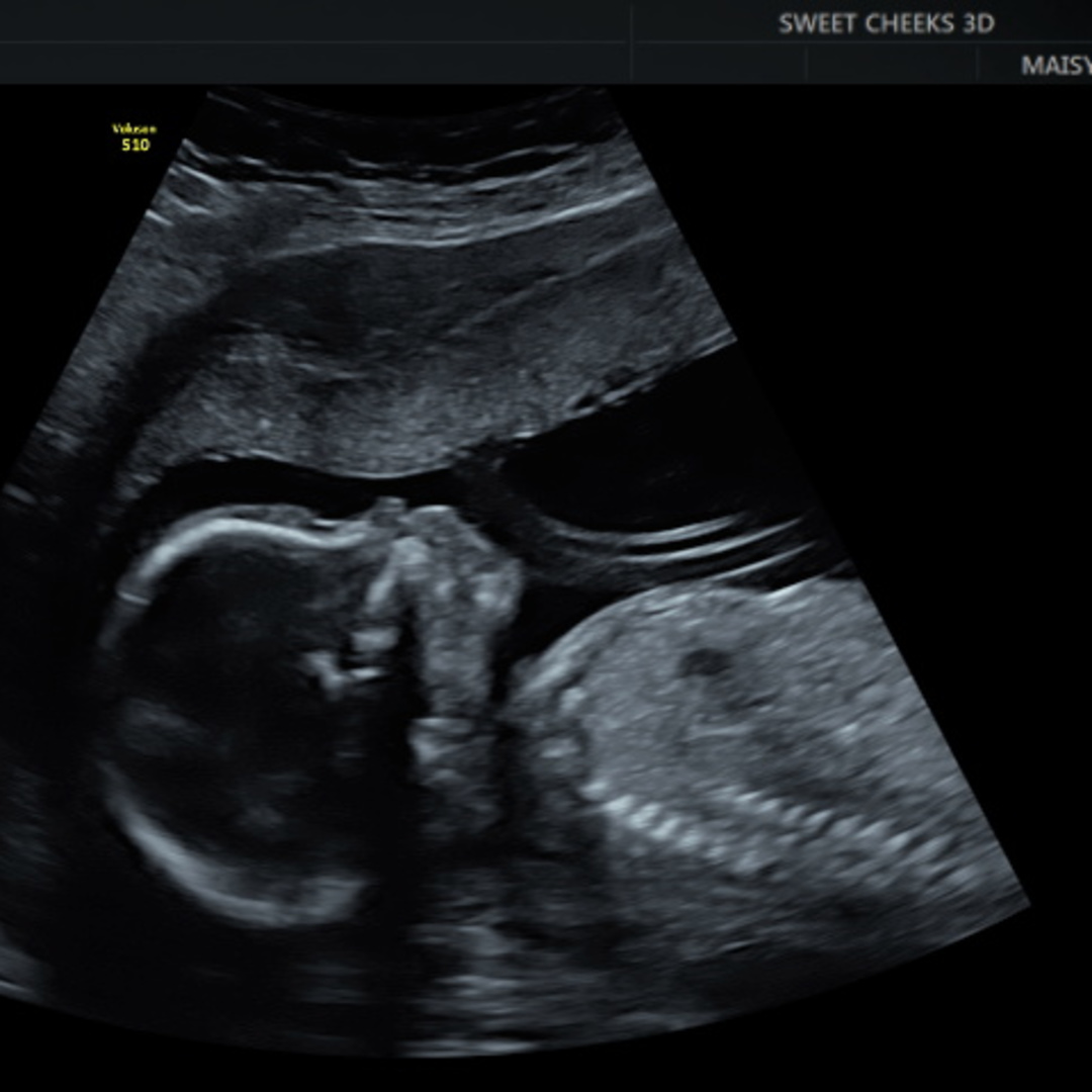 Photo shared by Madi for their Babylist baby registry.