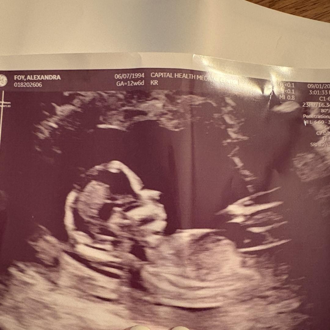 Photo shared by Alex for their Babylist baby registry.
