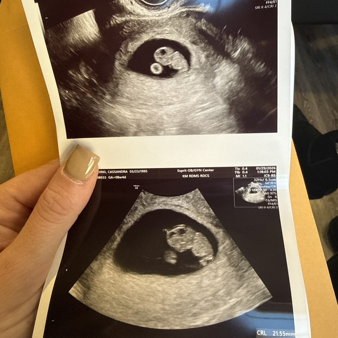 Photo shared by Cassi for their Babylist baby registry.