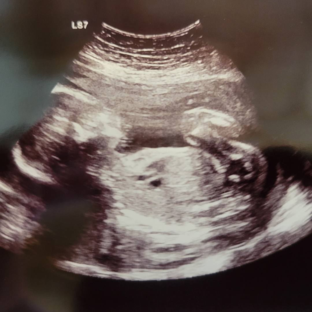 Photo shared by Jessica for their Babylist baby registry.