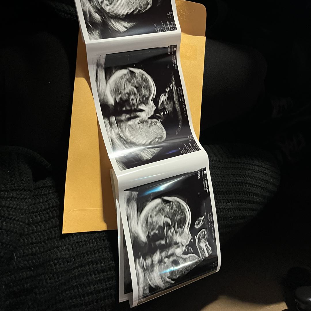 Photo shared by Zoe for their Babylist baby registry.