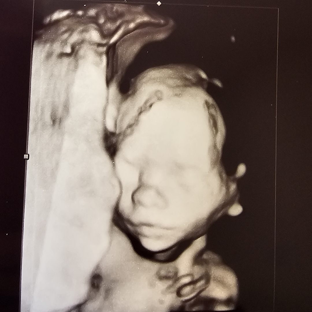 Photo shared by Sarah for their Babylist baby registry.