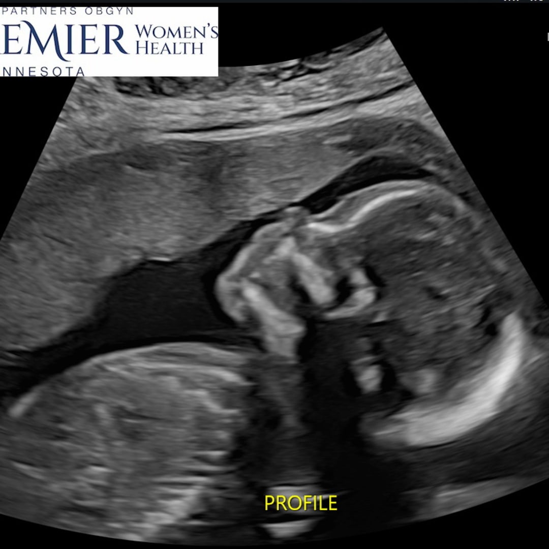 Photo shared by Grace for their Babylist baby registry.