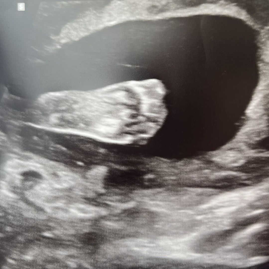 Photo shared by Nicole for their Babylist baby registry.