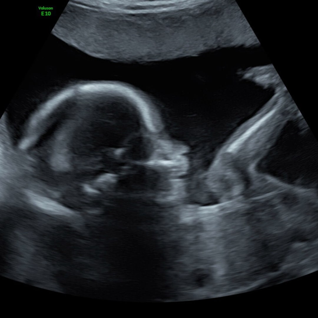 Photo shared by Misty for their Babylist baby registry.