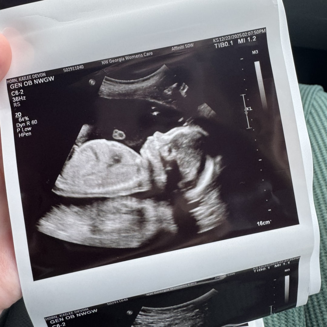 Photo shared by Kailee for their Babylist baby registry.