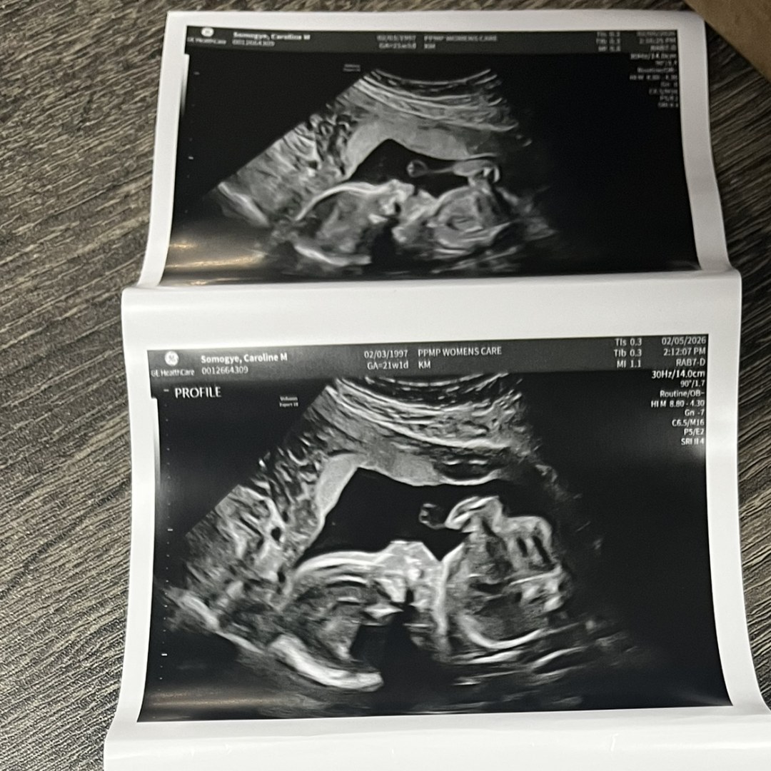 Photo shared by Caroline for their Babylist baby registry.