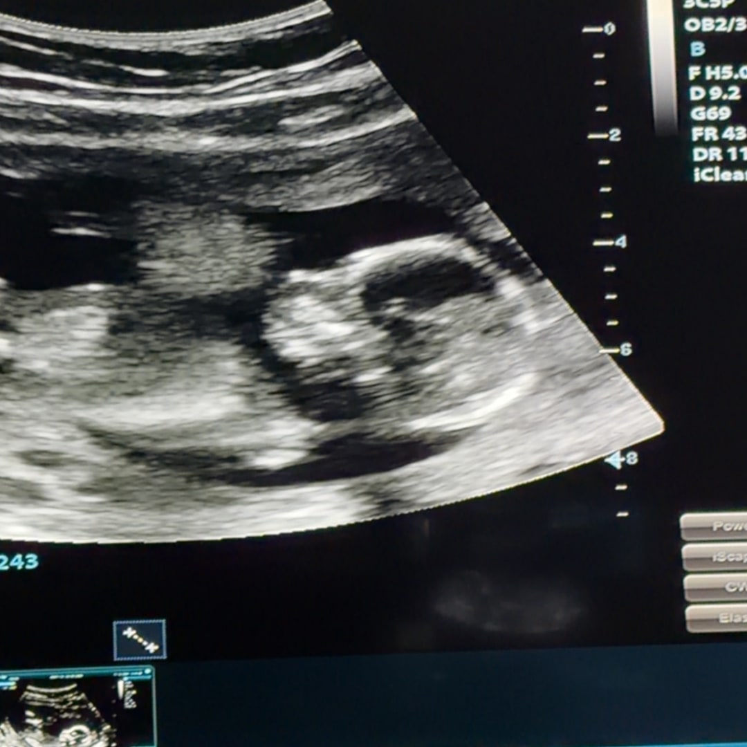 Photo shared by Makenna for their Babylist baby registry.
