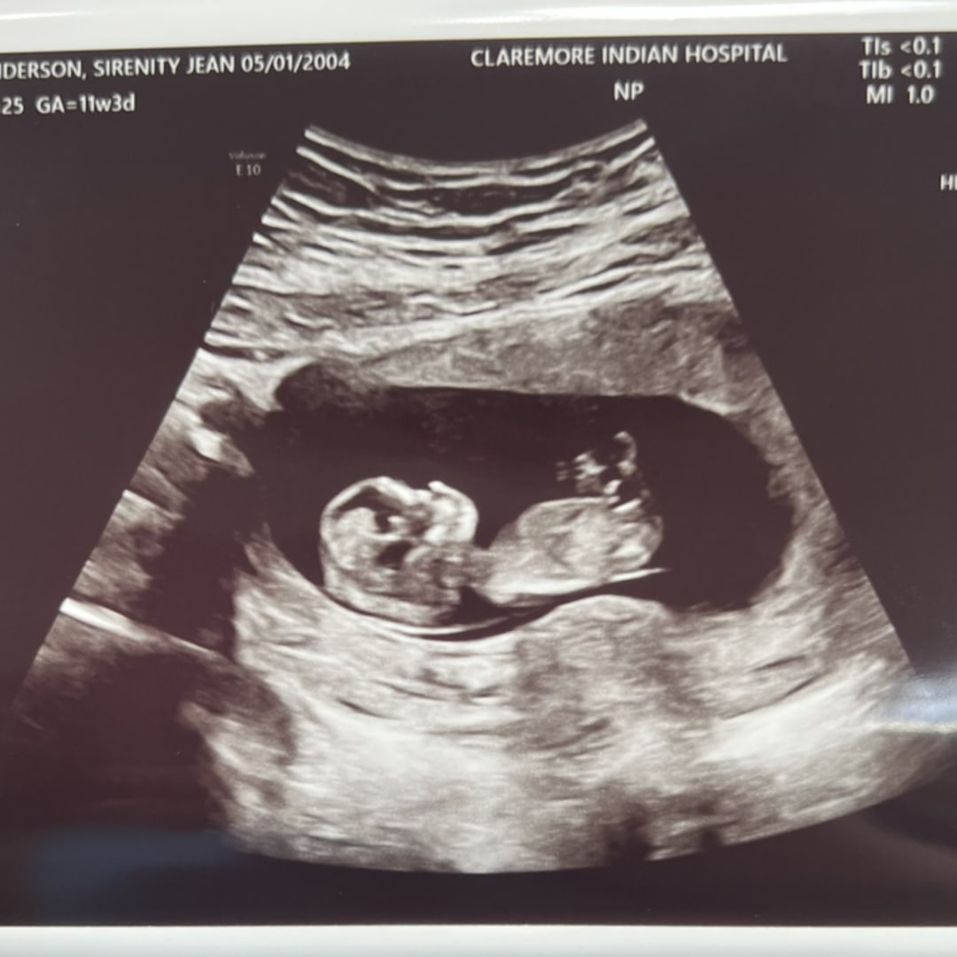 Photo shared by Siren for their Babylist baby registry.