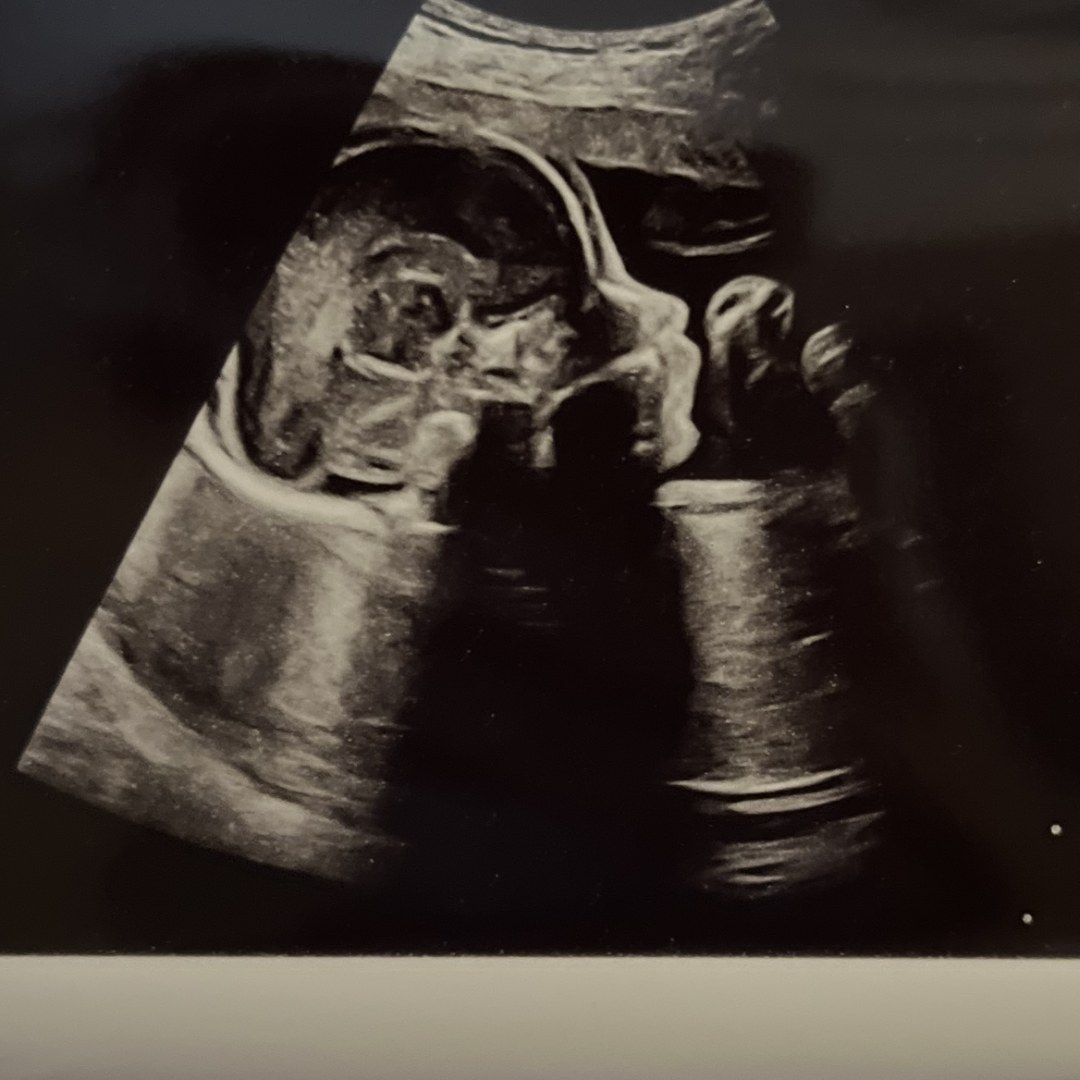 Photo shared by Stephanie for their Babylist baby registry.