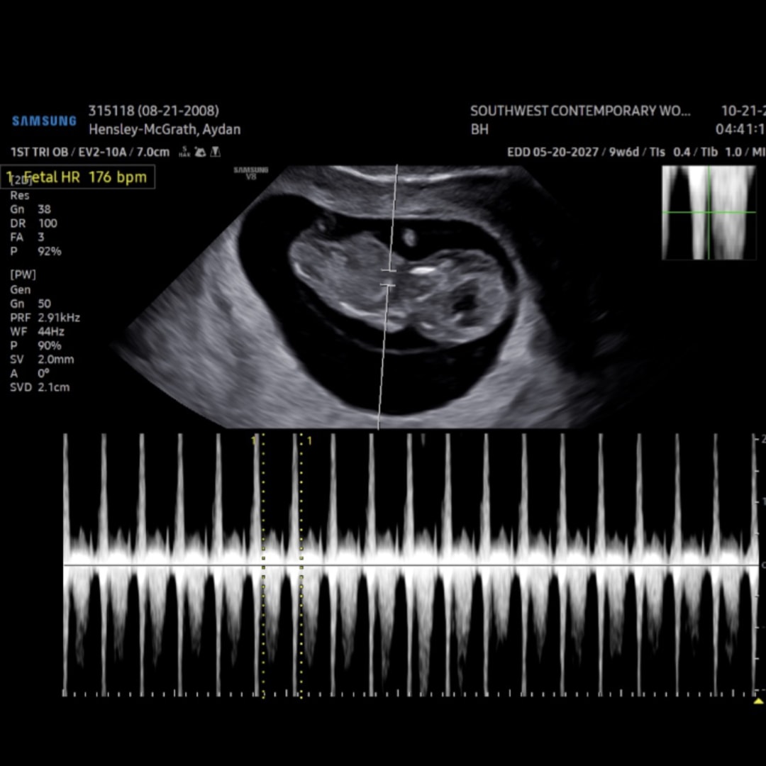 Photo shared by Aydan for their Babylist baby registry.