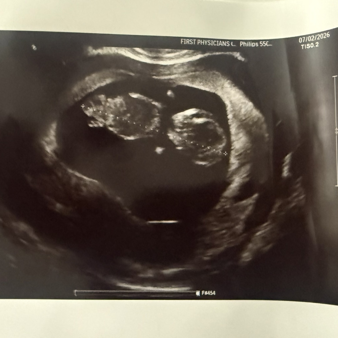 Photo shared by Hanna for their Babylist baby registry.