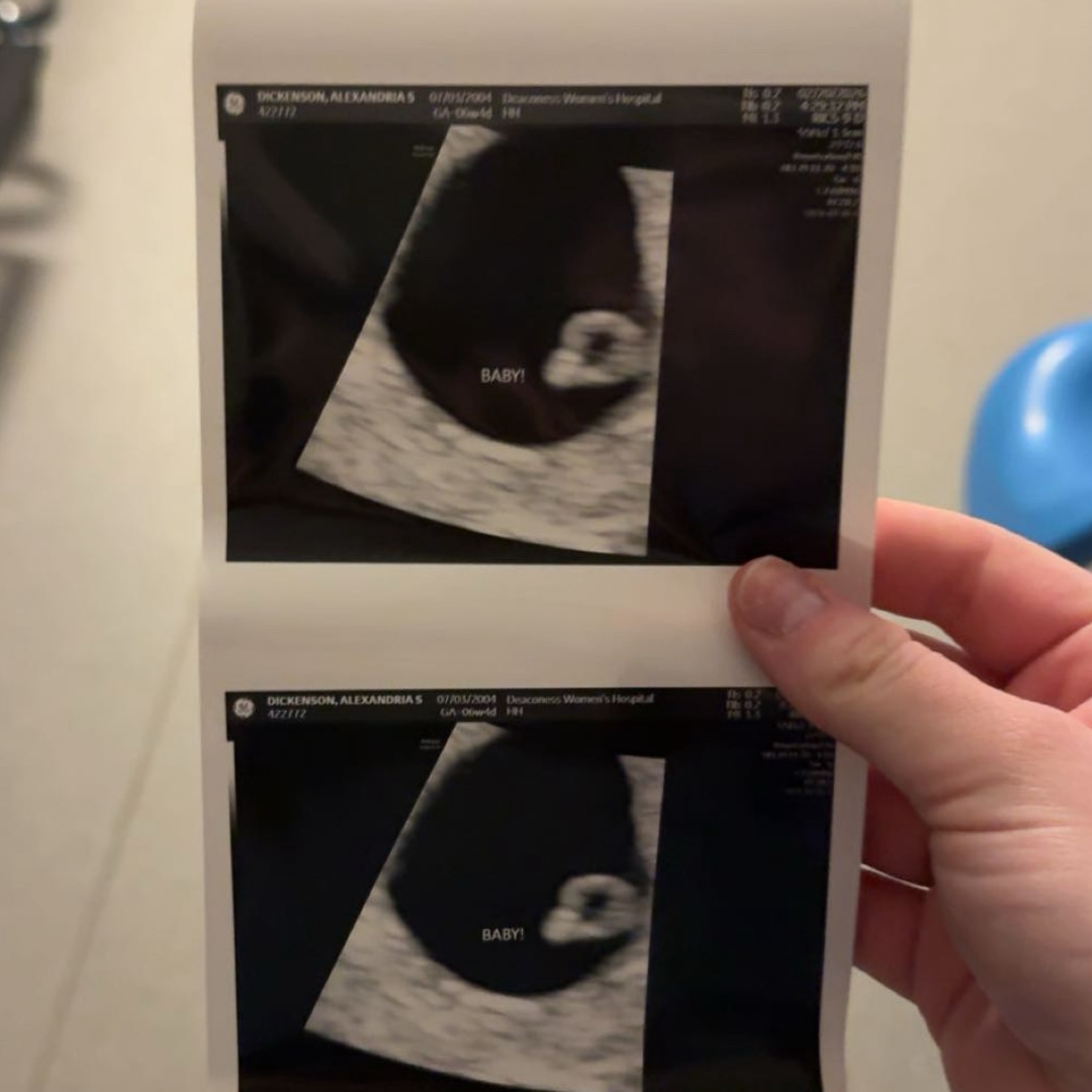 Photo shared by Skye for their Babylist baby registry.