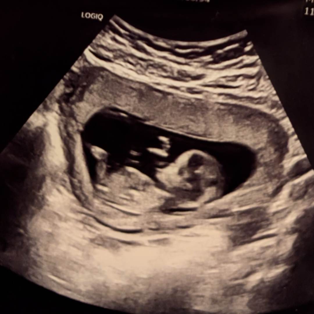 Photo shared by Destiny for their Babylist baby registry.