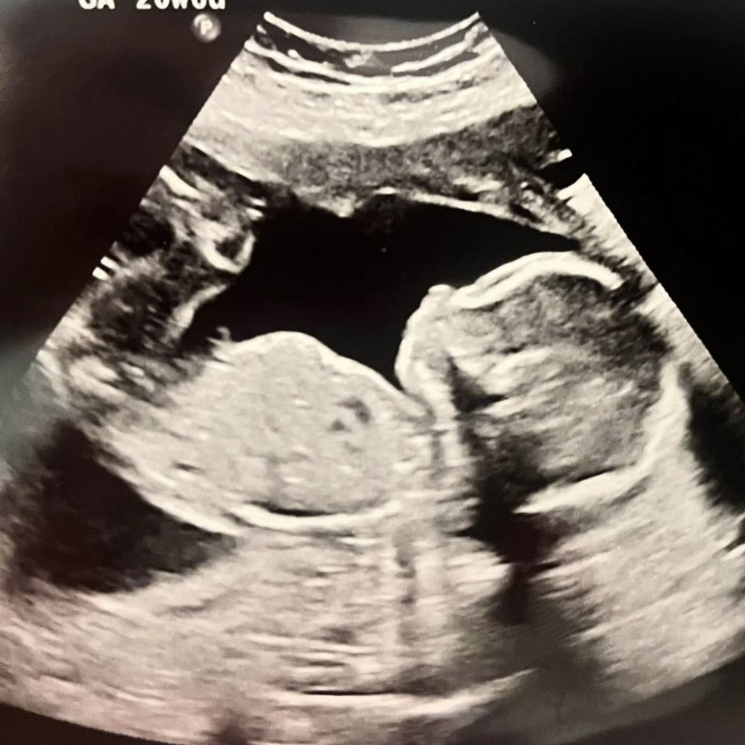 Photo shared by Jessica for their Babylist baby registry.