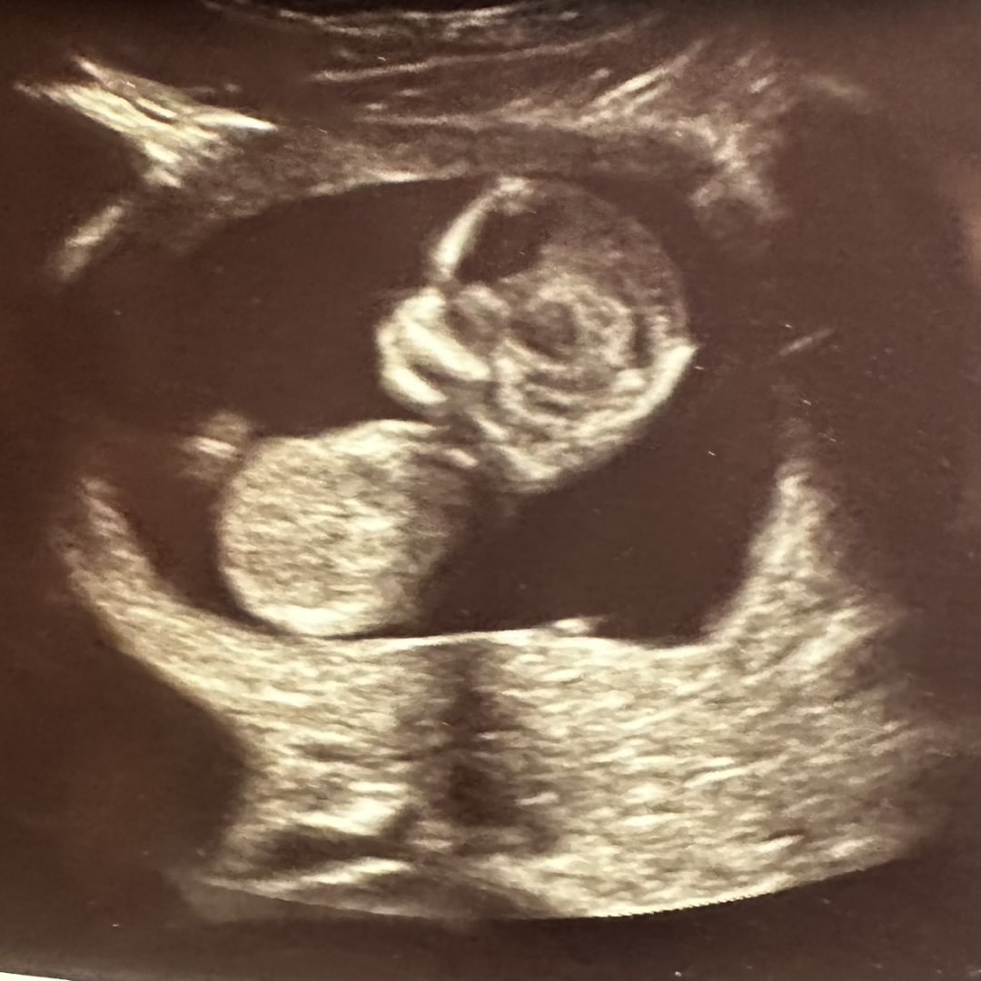 Photo shared by Emma for their Babylist baby registry.