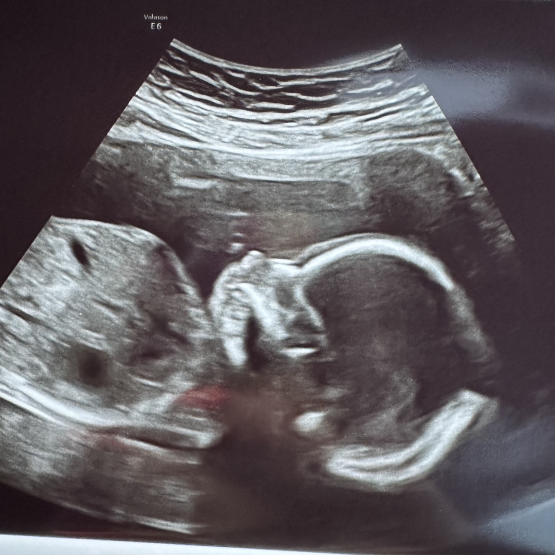 Photo shared by Nicole for their Babylist baby registry.