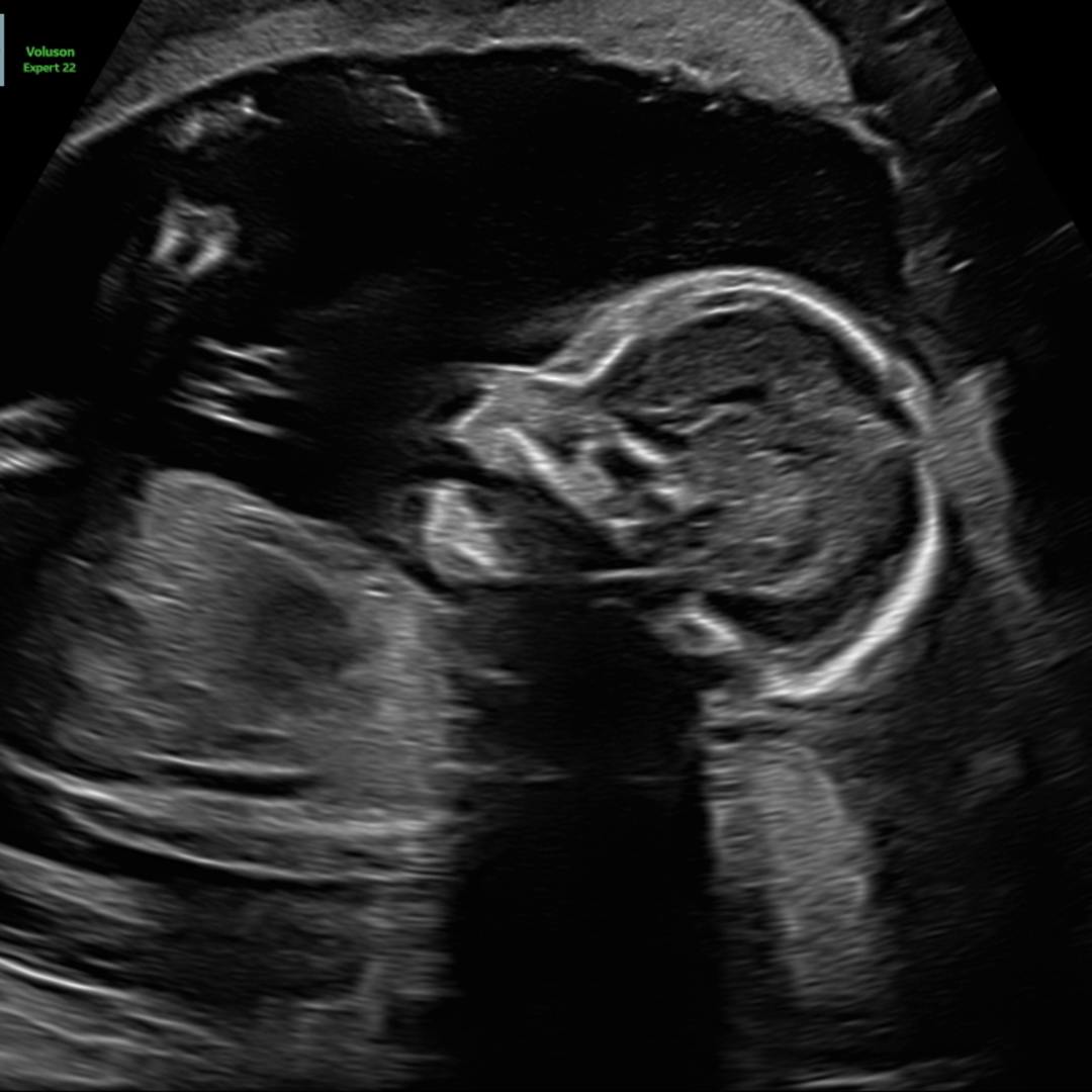 Photo shared by Molly for their Babylist baby registry.