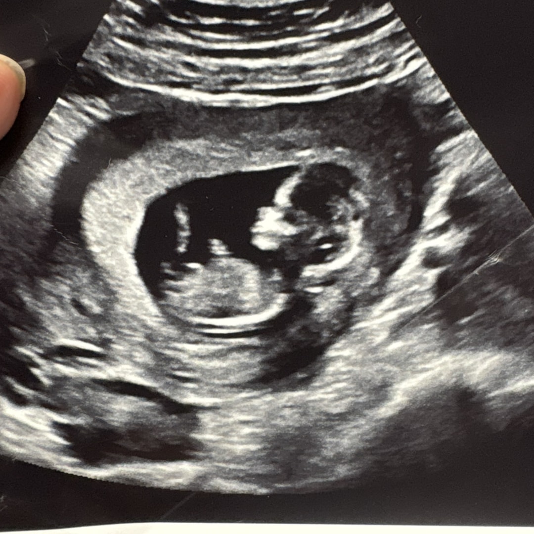 Photo shared by Tia for their Babylist baby registry.