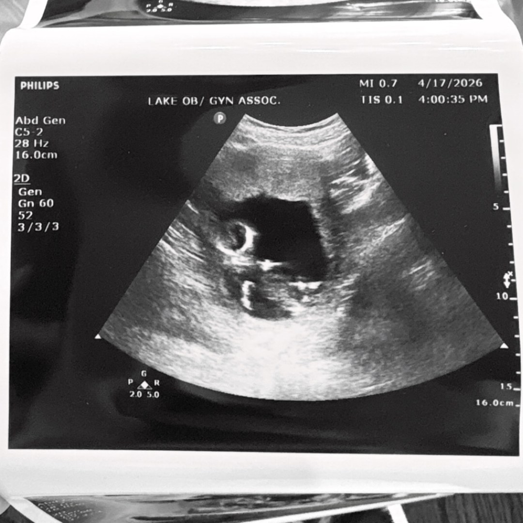 Photo shared by Ella for their Babylist baby registry.