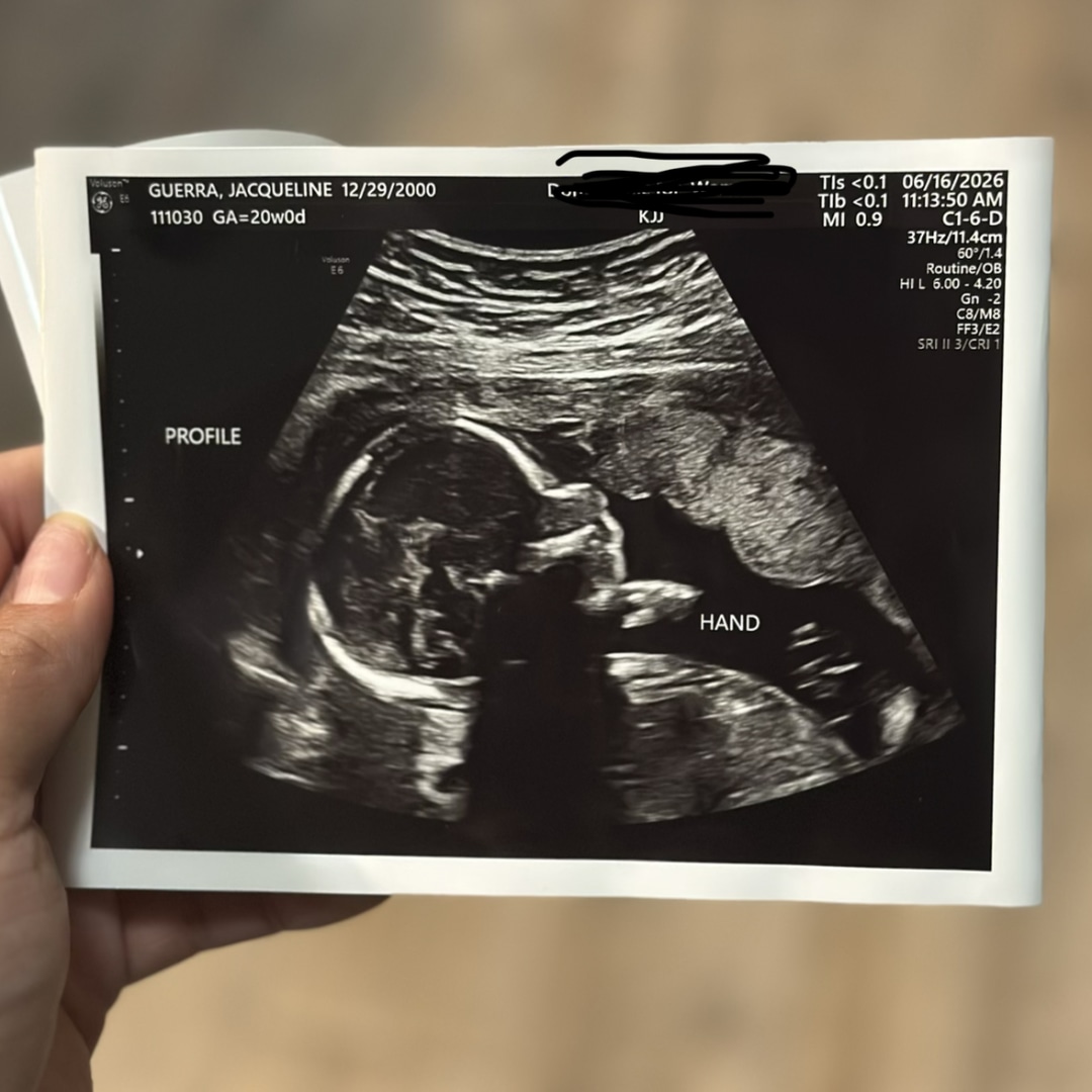 Photo shared by Jackie for their Babylist baby registry.