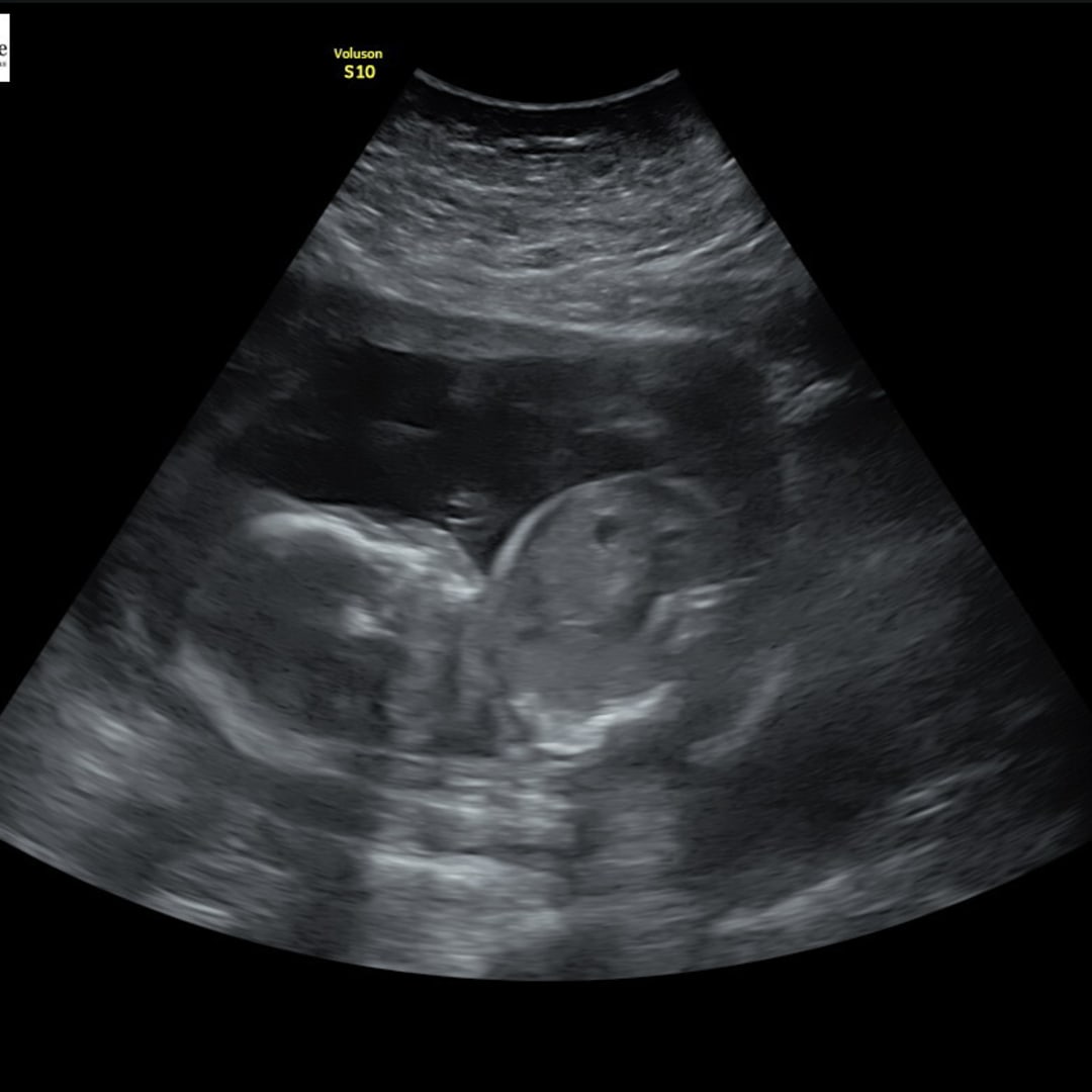 Photo shared by Catherine for their Babylist baby registry.