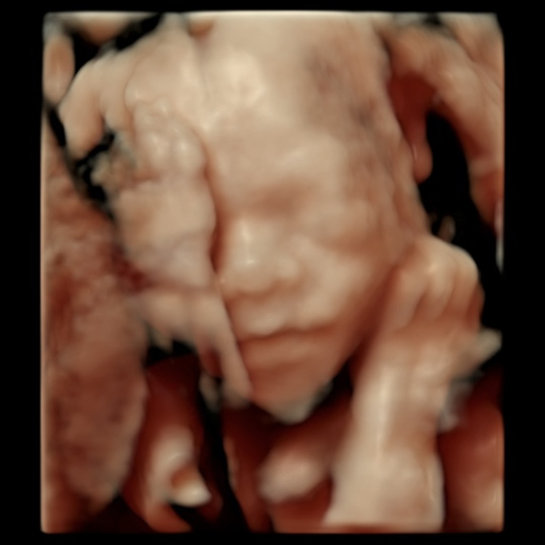 Photo shared by Cassandra for their Babylist baby registry.