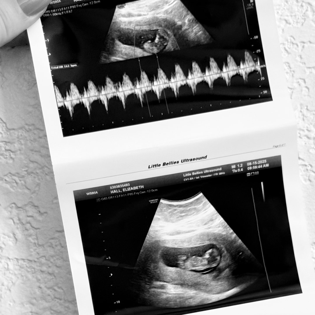 Photo shared by Elizabeth for their Babylist baby registry.
