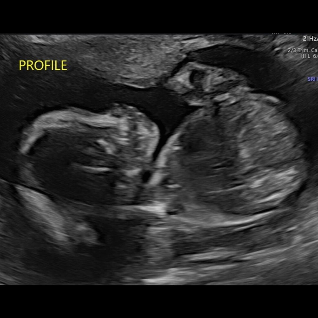 Photo shared by Amanda for their Babylist baby registry.