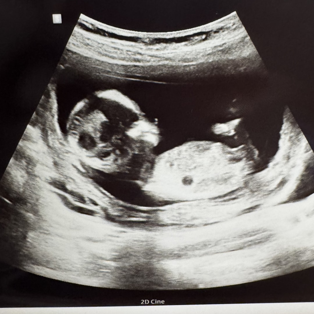 Photo shared by Amanda for their Babylist baby registry.