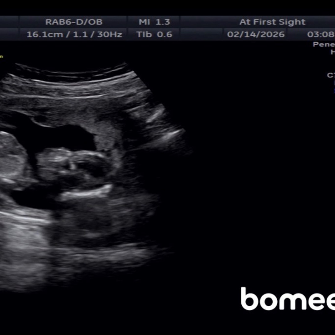 Photo shared by Emily for their Babylist baby registry.