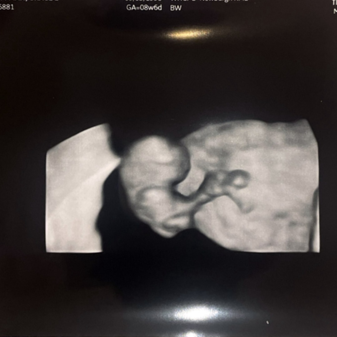Photo shared by Grace for their Babylist baby registry.