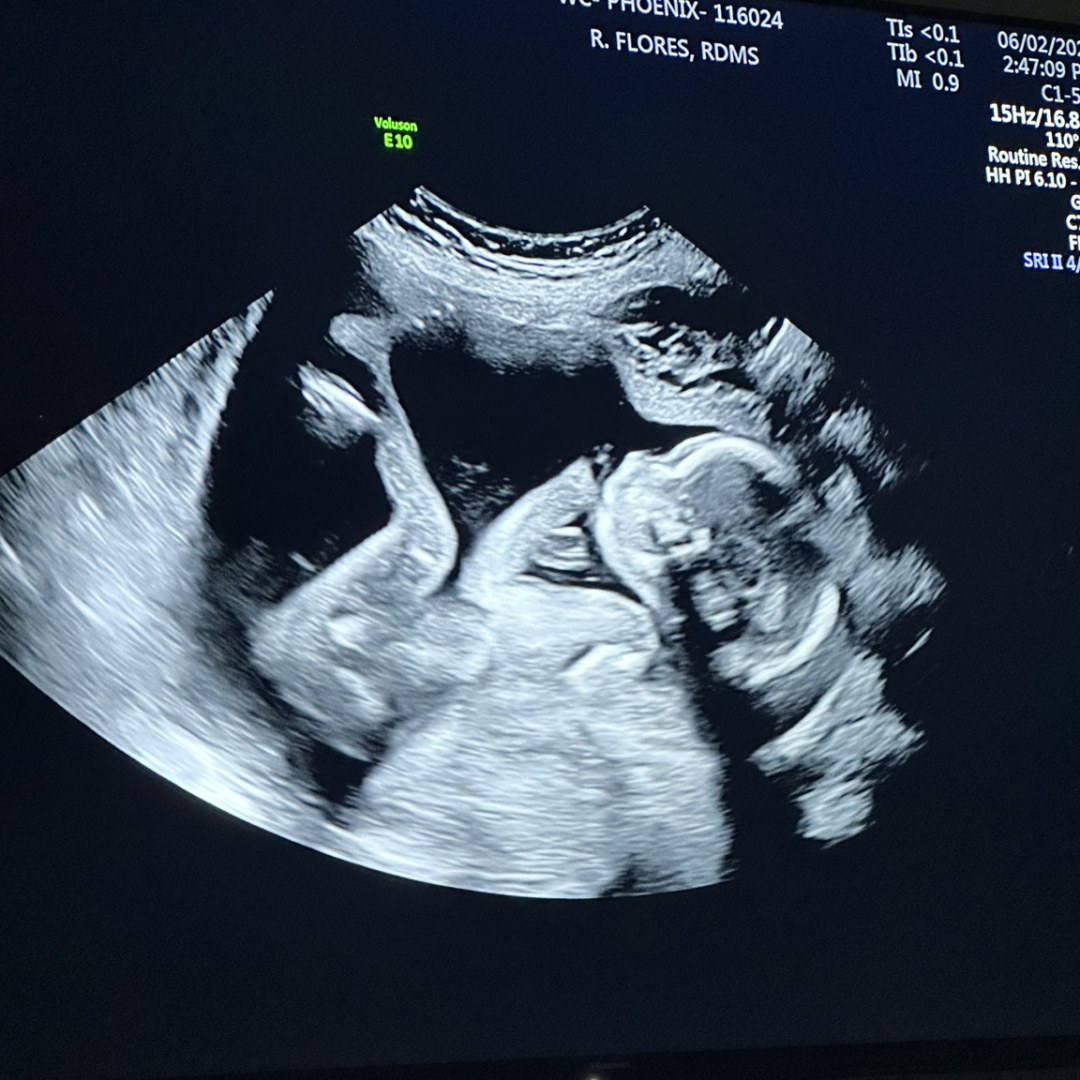 Photo shared by Alex for their Babylist baby registry.