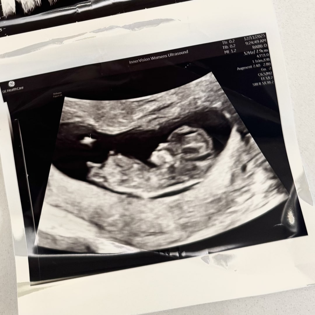 Photo shared by Kristan for their Babylist baby registry.