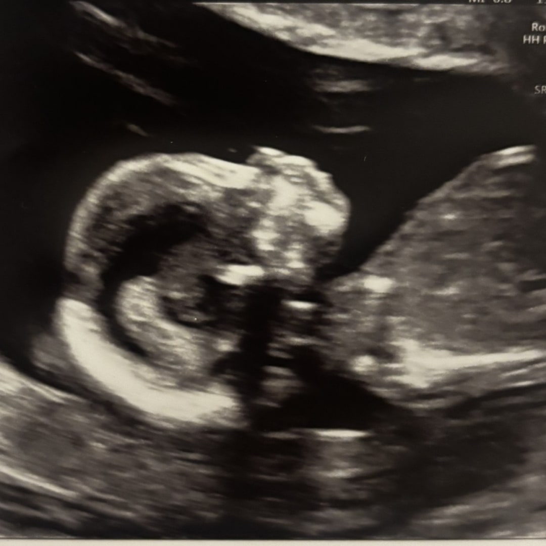 Photo shared by McKenna for their Babylist baby registry.