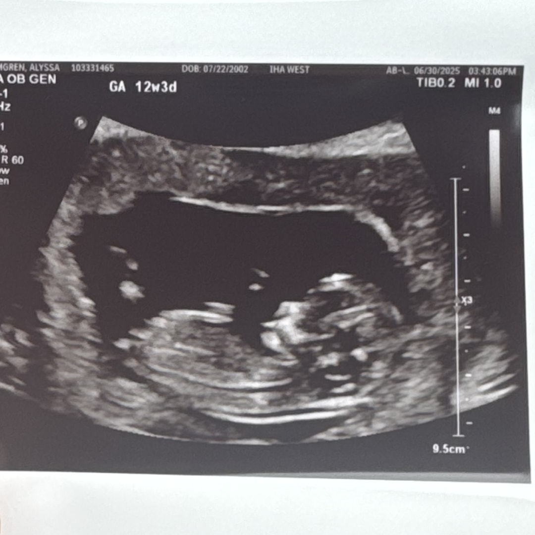 Photo shared by Alyssa for their Babylist baby registry.