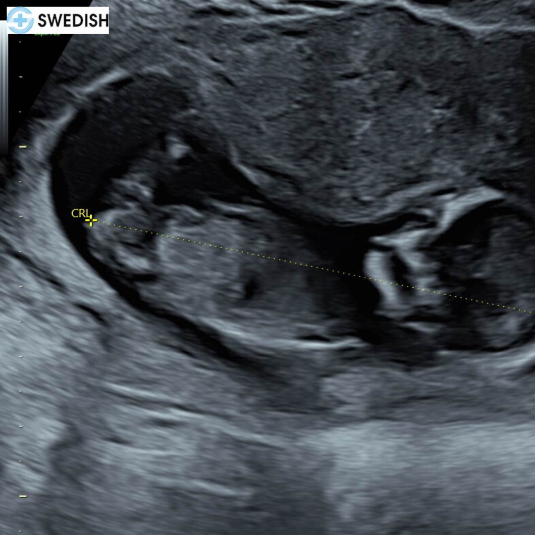 Photo shared by Shayla for their Babylist baby registry.