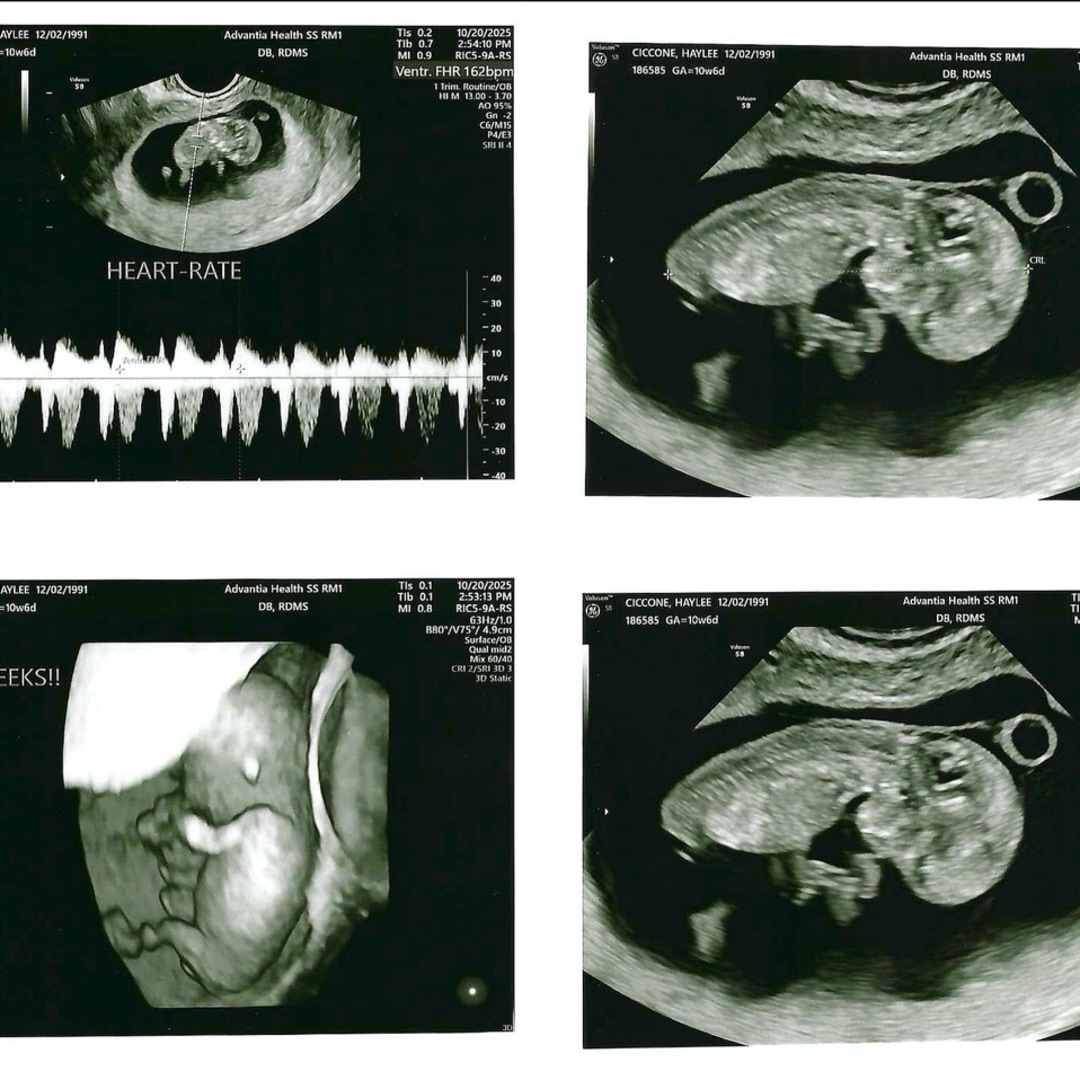 Photo shared by Haylee for their Babylist baby registry.