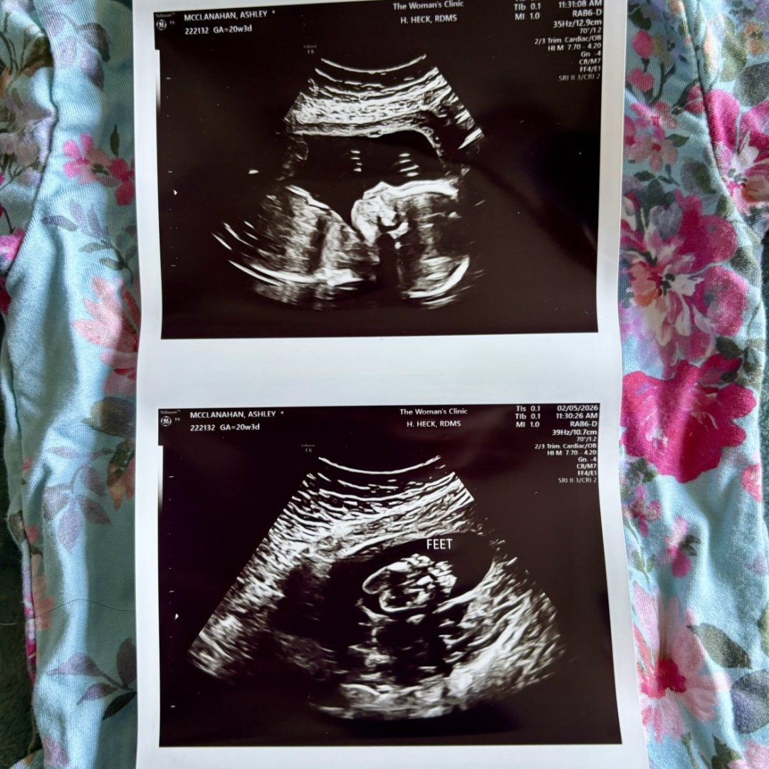 Photo shared by Ashley for their Babylist baby registry.